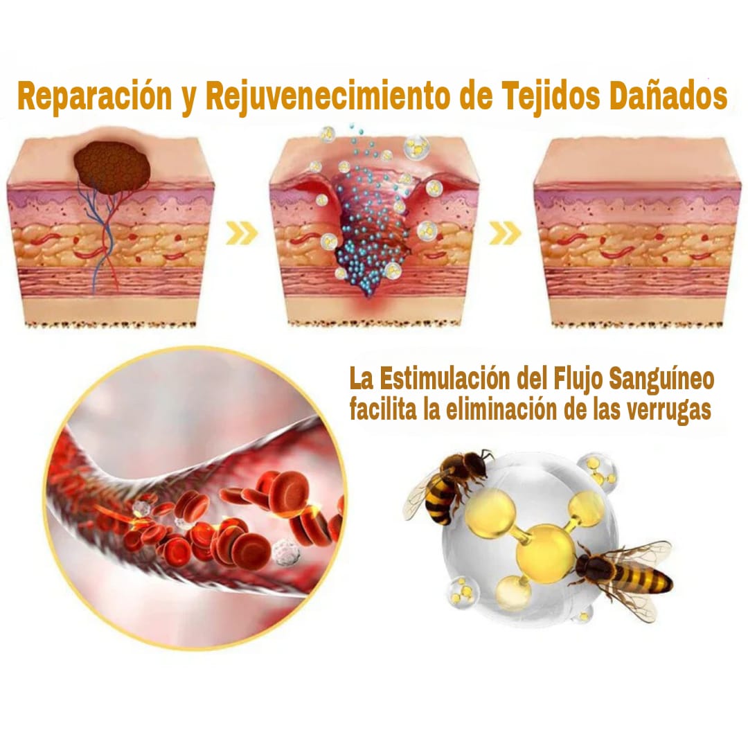 Aerosol contra el veneno de abeja