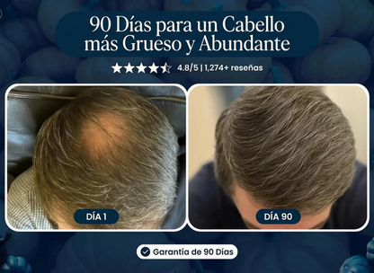 EXCALVO: Crece Tu Cabello Naturalmente De Nuevo