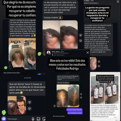 EXCALVO: Crece Tu Cabello Naturalmente De Nuevo